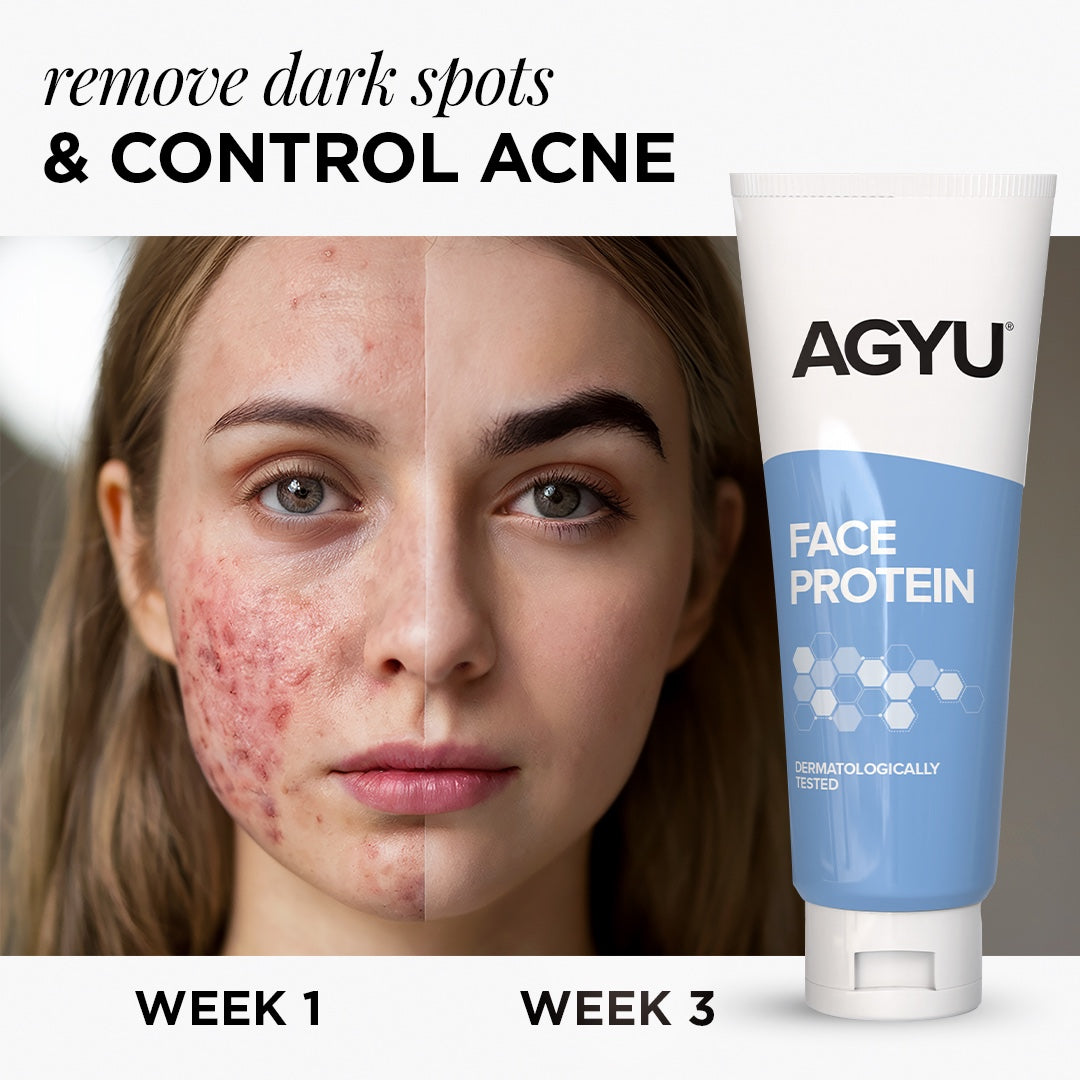 AGYU Face Protein Night Cream for Normal to Oily Skin | Repairs Pigmentation, Uneven Skin Tone & Dark Spots | Improves Skin Firmness | Beginner Friendly | 100Gm (Pack of 4)