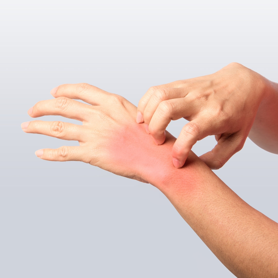 Itchiness and Skin Rashes: How to Identify and Treat Them?