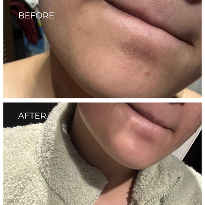 Face Wash - Face Cleanser with Beetroot