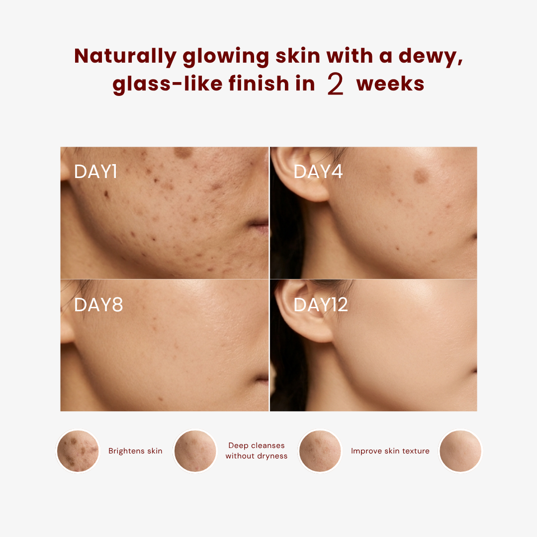 AGYU Rice water face wash combo